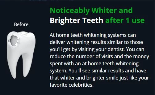 True Brilliance Teeth Whitening Pen Try Now